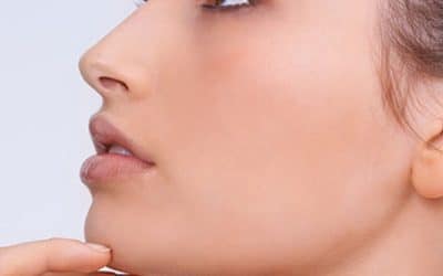Defining the jawline with dermal fillers