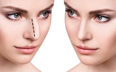 A Non Surgical Nose Job May Be Best for You