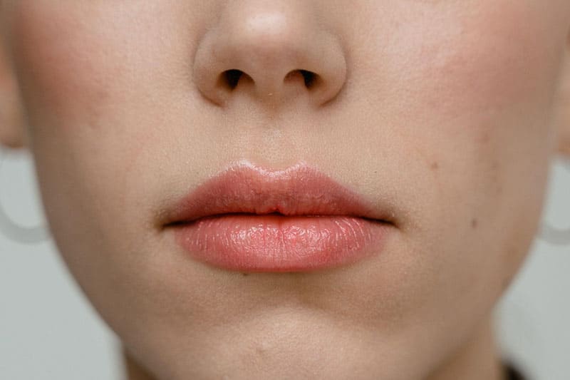 Lip fillers are popular, so you need to know the answers to frequently asked questions about them.