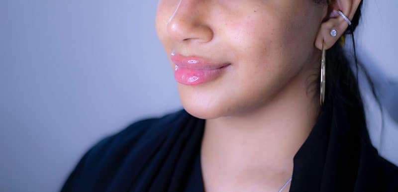 Harley Street is the best area in London for your lip filler treatment.