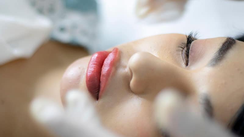A lip filler consultation includes examining your current condition.