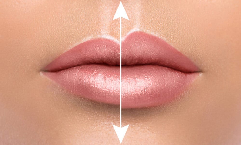 If you're feeling thinner lips, non surgical procedures can help.