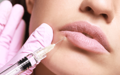 Types of Lip Fillers: What To Know Before Your Consultation