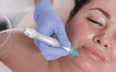 Best Treatment for Large Pores Non-surgical Cosmetic Procedures