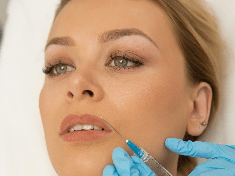 There are many kinds of lip fillers in the market.