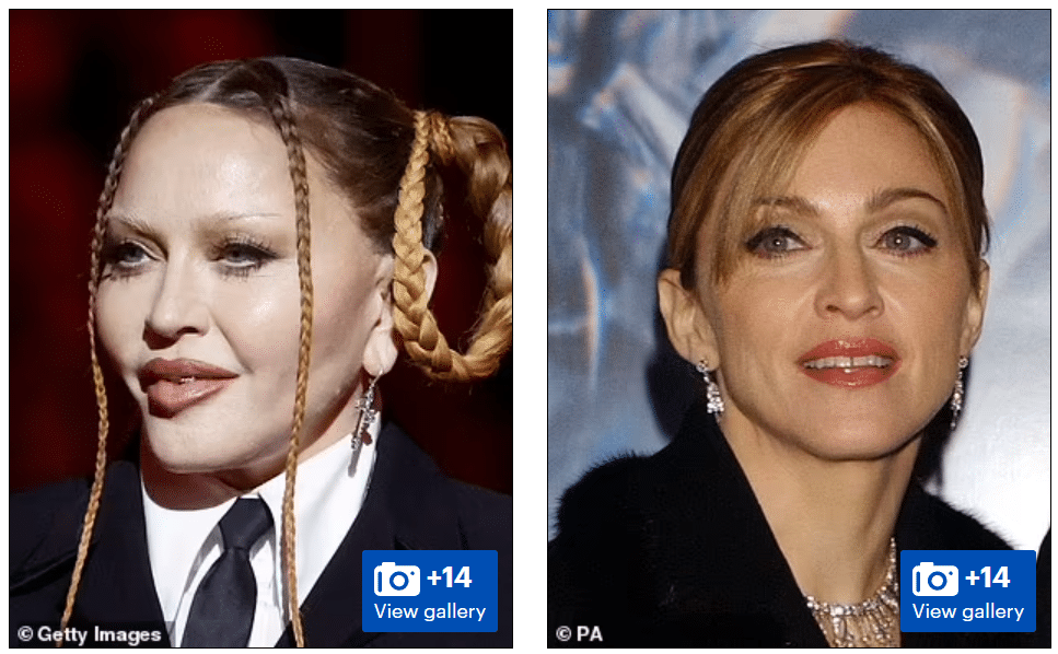 Madonna's changing appearance caused concern among fans who have speculated how she aged gracefully.
