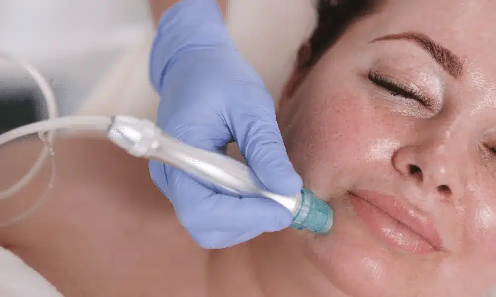 Skin Rejuvenation And Aesthetics