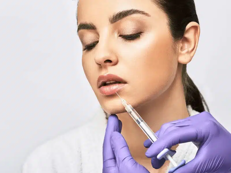 If you want to have lip augmentation using a dermal filler, hyaluronic acid fillers would be the ideal option.
