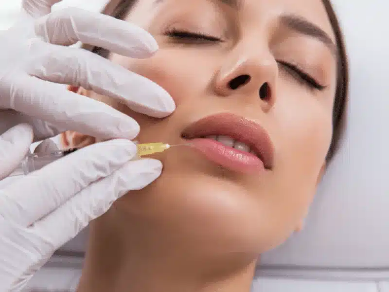 Injected into the skin, dermal fillers help recover lost volume and soften creases.