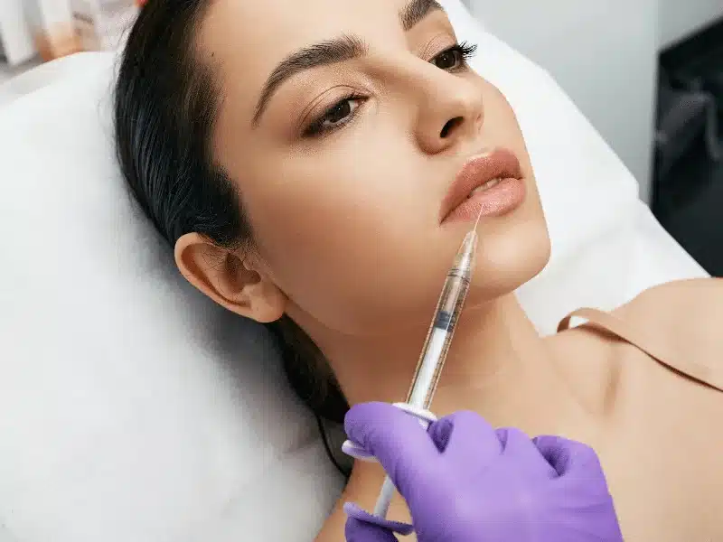 Lip fillers are a popular cosmetic treatment that can be used to enhance the appearance of the lips.